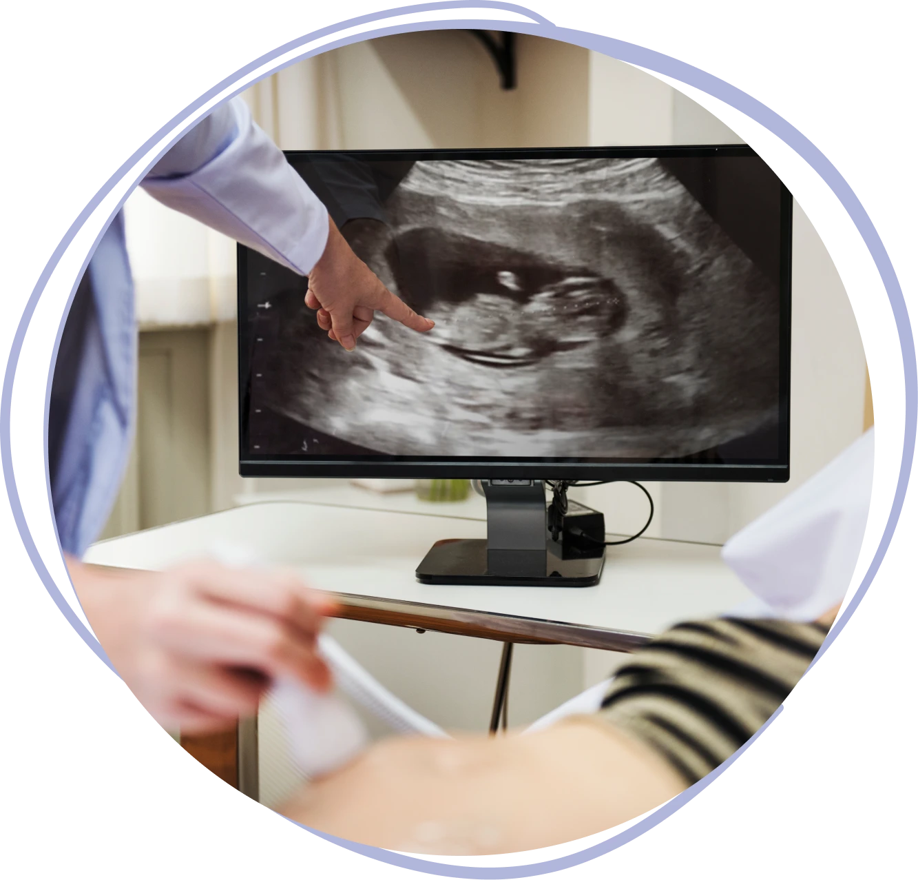 Monitorización fetal